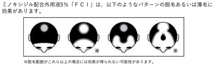 ミノキシジル配合外用液「FCI」